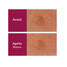 Achat Sérum concentré anti-taches Centifolia