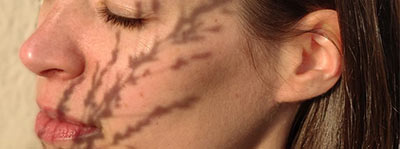 Diagnostic de peau