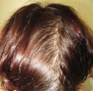 Après 3ème coloration